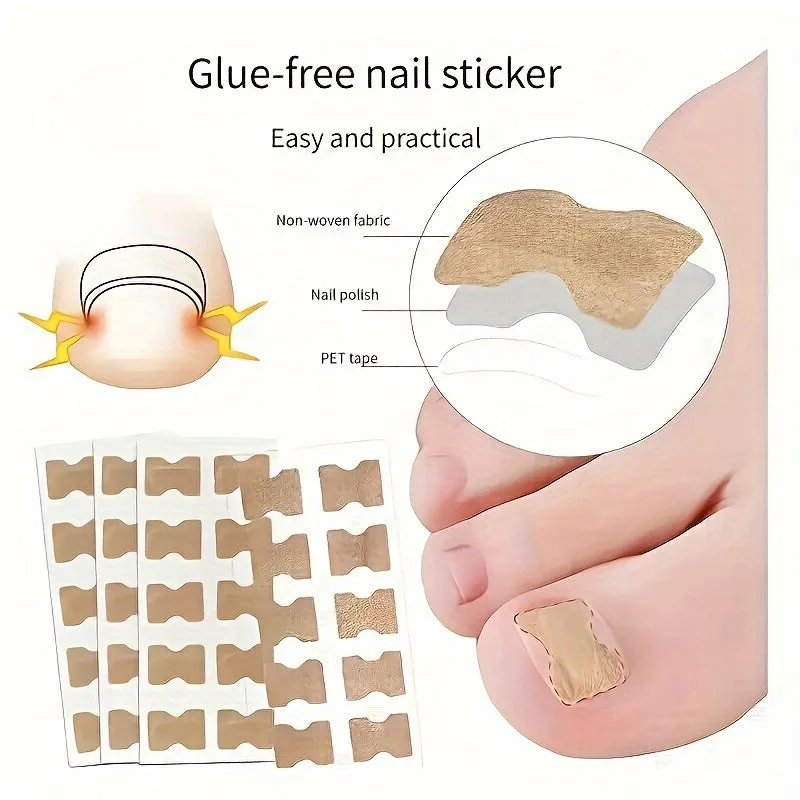 Painless Ingrown Toenail Corrector Stickers GlueFree Pedicure Solution